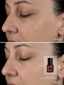 Luminara Elixir – Siero Radiance Anti-Età